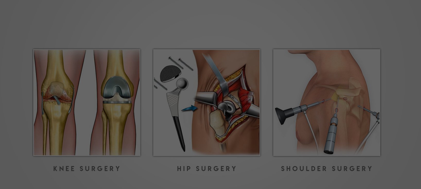 Surgeons for sports injuries