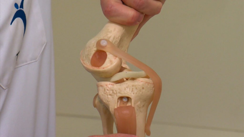 Knee Injury