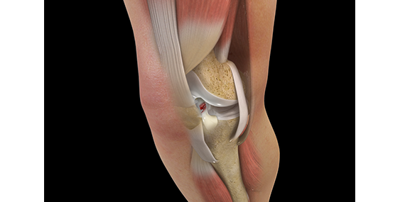 What Is An ACL Injury, And Who Treats It?